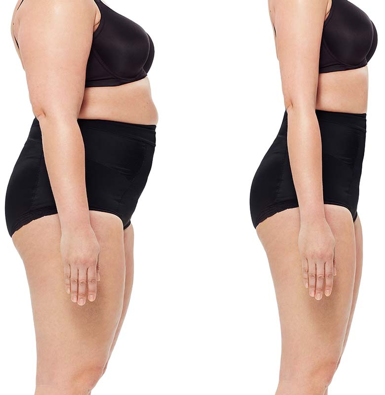 weight-loss
